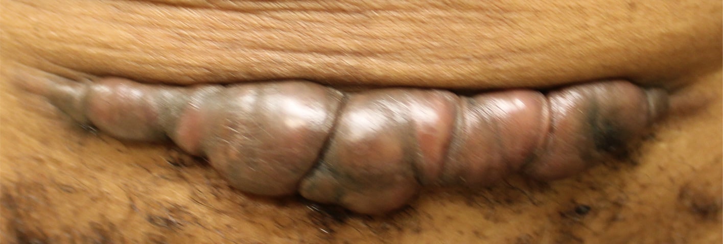 Removal of Keloids - picture before