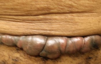 Removal of pubis - picture before